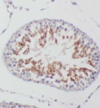 EIF2S2 Rabbit Polyclonal Antibody