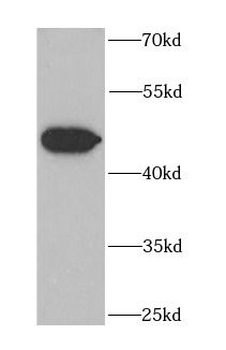 EIF2S3 Rabbit Polyclonal Antibody