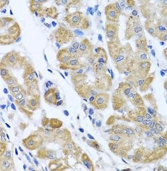 EIF2S3 Rabbit Polyclonal Antibody
