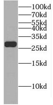 EIF4E2 Rabbit Polyclonal Antibody