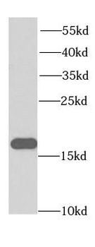 EIF5A Rabbit Polyclonal Antibody