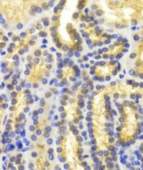 EIF5A Rabbit Polyclonal Antibody