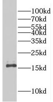 EIF5A2 Rabbit Polyclonal Antibody