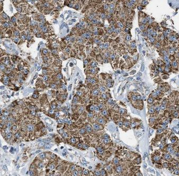 EIF5A2 Rabbit Polyclonal Antibody