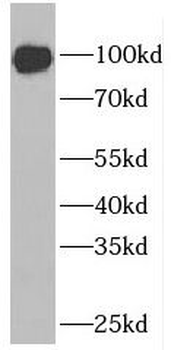 ELF1 Rabbit Polyclonal Antibody