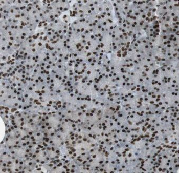 ELF1 Rabbit Polyclonal Antibody