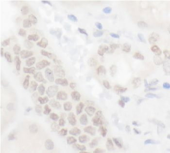 ELF1 Rabbit Polyclonal Antibody