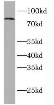 ELMO2 Rabbit Polyclonal Antibody