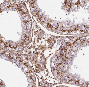 ELOVL2 Rabbit Polyclonal Antibody