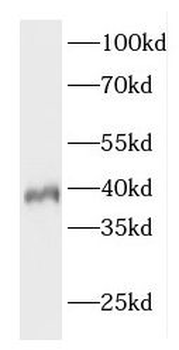 ELOVL4 Antibody