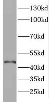 ELOVL6 Antibody