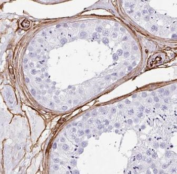 EMB Rabbit Polyclonal Antibody