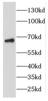 EME1 Rabbit Polyclonal Antibody