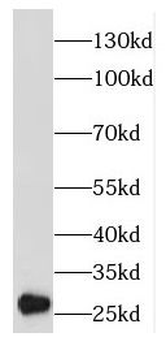 EMG1 Rabbit Polyclonal Antibody