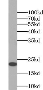 EDN1 Rabbit Polyclonal Antibody