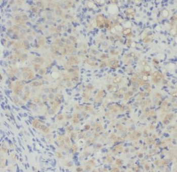 ENOX2 Rabbit Polyclonal Antibody