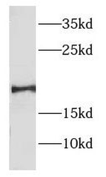 ENSA Rabbit Polyclonal Antibody
