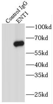 SLC29A1 Rabbit Polyclonal Antibody
