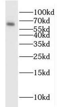SLC29A1 Rabbit Polyclonal Antibody