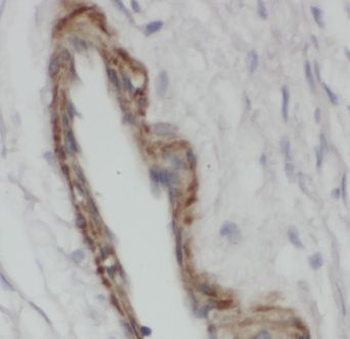 SLC29A1 Rabbit Polyclonal Antibody