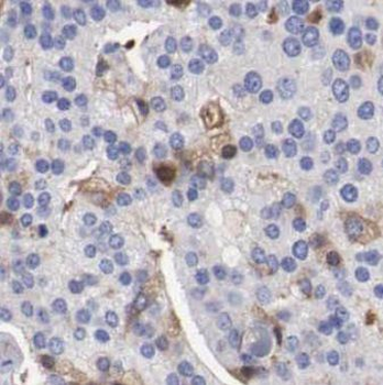 ENTPD6 Rabbit Polyclonal Antibody
