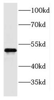 PROCR Rabbit Polyclonal Antibody