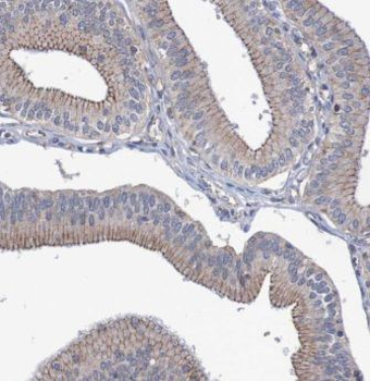 PROCR Rabbit Polyclonal Antibody