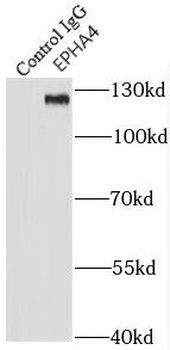 EPHA4 Rabbit Polyclonal Antibody