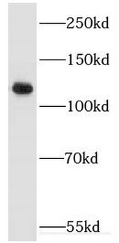 EPHA4 Rabbit Polyclonal Antibody