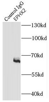 EPHX2 Rabbit Polyclonal Antibody