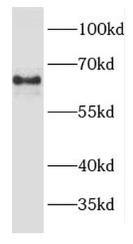 EPHX2 Rabbit Polyclonal Antibody