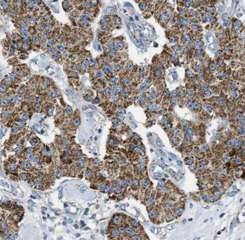EPHX2 Rabbit Polyclonal Antibody
