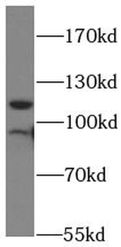 LIMA1 Antibody