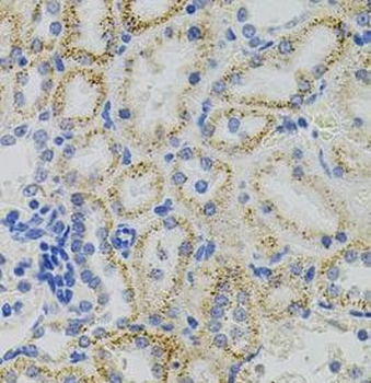 EPO Rabbit Polyclonal Antibody