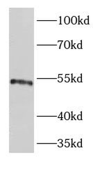 EPOR Rabbit Polyclonal Antibody