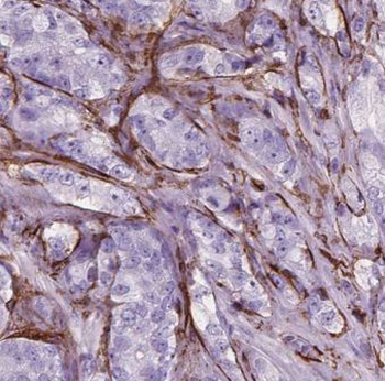 EPOR Rabbit Polyclonal Antibody