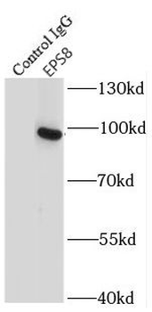 EPS8 Rabbit Polyclonal Antibody