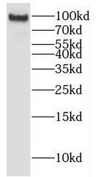 EPS8 Rabbit Polyclonal Antibody
