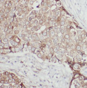 EPS8 Rabbit Polyclonal Antibody