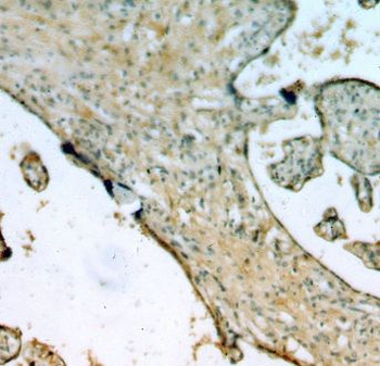 EPS8L2 Rabbit Polyclonal Antibody