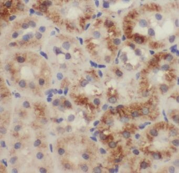 ERBIN Rabbit Polyclonal Antibody