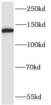 ERC1 Rabbit Polyclonal Antibody