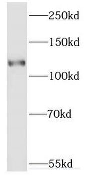 ERC2 Rabbit Polyclonal Antibody