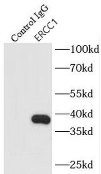 ERCC1 Rabbit Polyclonal Antibody