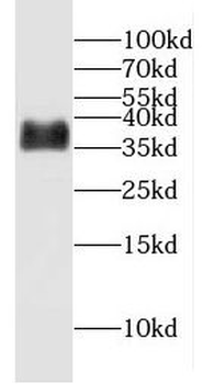 ERCC1 Rabbit Polyclonal Antibody