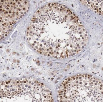 ERCC1 Rabbit Polyclonal Antibody