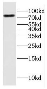 ERCC2 Antibody