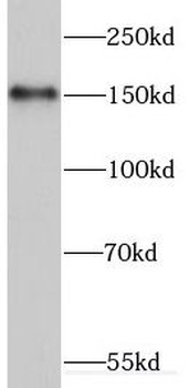 ERCC6 Antibody
