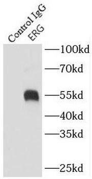 ERG Rabbit Polyclonal Antibody