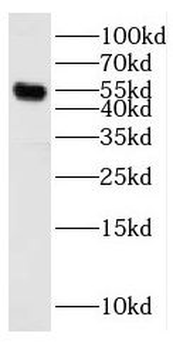 ERG Rabbit Polyclonal Antibody